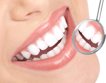 Tooth Whitening in Millersville, MD