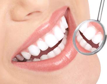 Professional Teeth Whitening Services in Millersville, MD