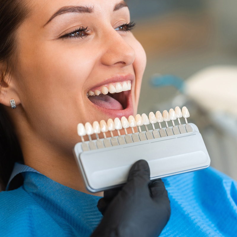 lady smiling with veneer samples